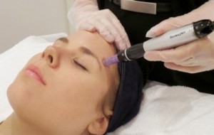 Вернуть лицу молодость поможет микроигольчатая мезотерапия в E Cosmetology