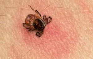 Эритема после укуса клеща? Что это такое?