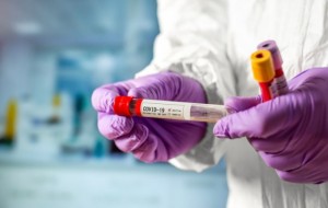 В Україні зареєстровано 480 випадків зараження коронавірусом