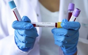 У Київській області підтверджено 2610 випадків захворювання на коронавірус