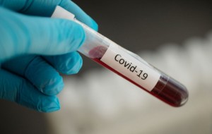 За добу на Львівщині виявили 120 нових випадків COVID-19